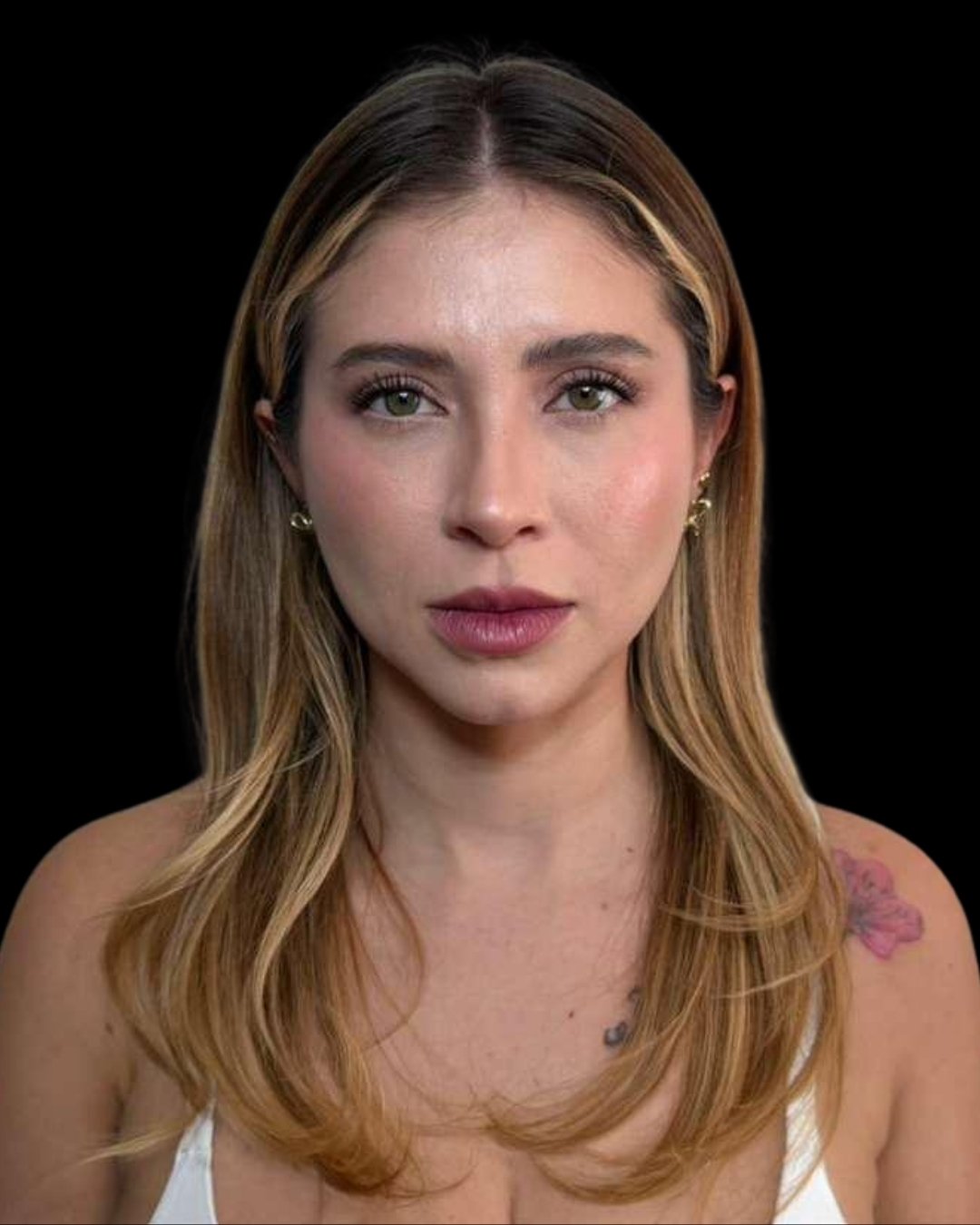 blefaroplastia-02